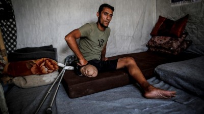 Gazzeli Hamid, ampute edilen bacağıyla hayata tutunmaya çalışıyor